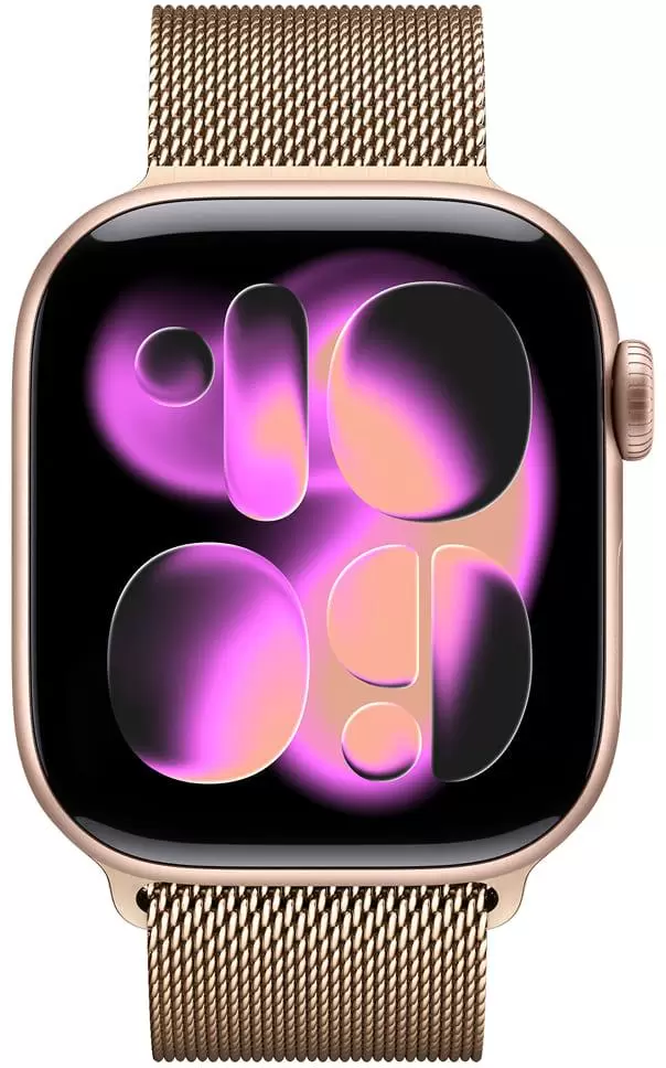 Умные часы Apple Watch Series 11 46 мм (алюминиевый корпус, розовое золото/золотистый, миланская петля) фото 2