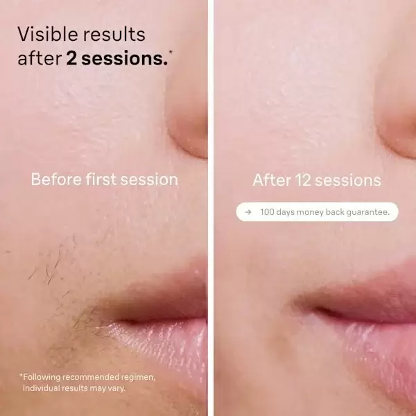 Фотоэпилятор Braun Silk-expert Pro 5 PL5242 фото 4