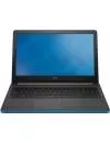 Ноутбук Dell Inspiron 15 5555 (5555-9198) фото 2