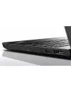 Ноутбук Lenovo ThinkPad Edge E555 (20DH001TRT) фото 11