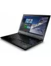 Ноутбук Lenovo ThinkPad L560 (20H6A0AHPB) фото 3