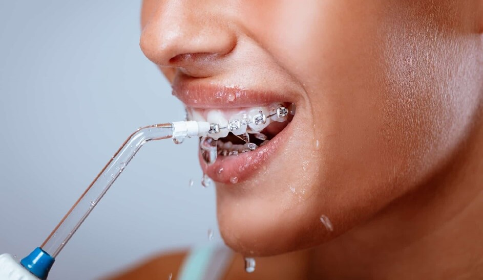 как выбрать ирригатор